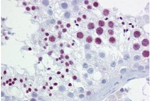 Anti-BRD3 antibody IHC staining of human testis.