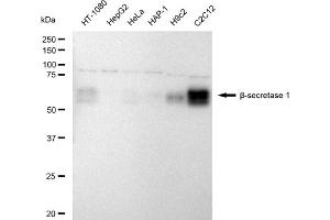Western blotting analysis using Beta-Secretase 1 antibody (ABIN7797765).