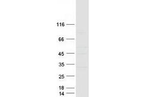 Keratin 18 Pseudogene 55 (KRT18P55) protein (Myc-DYKDDDDK Tag)