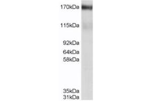 Western Blotting (WB) image for anti-ATP-Binding Cassette, Sub-Family C (CFTR/MRP), Member 4 (ABCC4) (C-Term) antibody (ABIN2465334) (ABCC4 antibody  (C-Term))