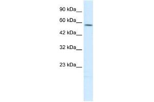 TPH2 antibody used at 1 ug/ml to detect target protein.