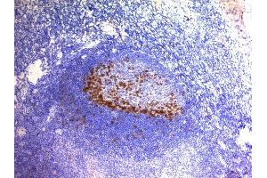 Formalin-fixed, paraffin-embedded human Tonsil stained with PD1 (CD279) Monoclonal Antibody (SPM597). (PD-1 antibody)