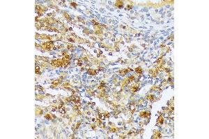 Immunohistochemistry of paraffin-embedded rat ovary using CF antibody (3087) at dilution of 1:100 (40x lens). (A1CF antibody  (AA 50-120))