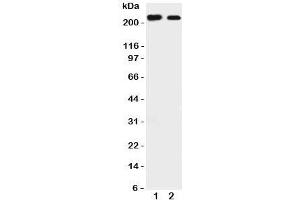 Western blot testing of Tuberin antibody and Lane 1:  rat liver;  2: mouse HEPA cell lysate. (Tuberin antibody  (C-Term))