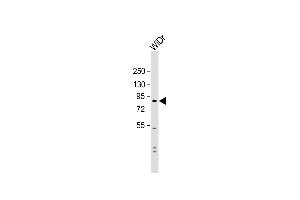 Anti-SUSD2 Antibody (C-term) at 1:1000 dilution + WiDr whole cell lysate Lysates/proteins at 20 μg per lane. (SUSD2 antibody  (C-Term))