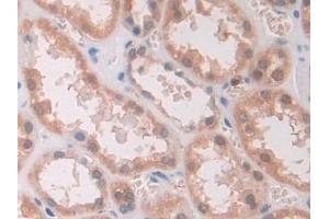 Detection of IL12A in Human Kidney Tissue using Monoclonal Antibody to Interleukin 12A (IL12A)