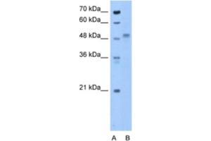 Western Blotting (WB) image for anti-Zona Pellucida Glycoprotein 4 (ZP4) antibody (ABIN2463282) (ZP4 antibody)