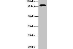 Western blot All lanes: DGKG antibody at 4 μg/mL + Mouse brain tissue Secondary Goat polyclonal to rabbit IgG at 1/10000 dilution Predicted band size: 90, 87, 85 kDa Observed band size: 90 kDa (DGKG antibody  (AA 1-255))