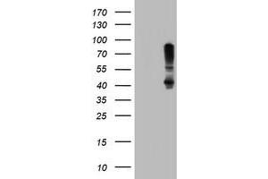 Image no. 1 for anti-serpin Peptidase Inhibitor, Clade B (Ovalbumin), Member 1 (SERPINB1) (AA 77-306) antibody (ABIN1491670) (SERPINB1 antibody  (AA 77-306))