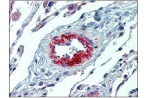Immunohistochemistry (IHC) image for anti-Interleukin 23, alpha subunit p19 (IL23A) antibody (ABIN614363) (IL23A antibody)