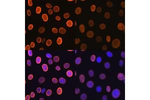 Immunofluorescence analysis of NIH-3T3 cells using Acetyl-Histone H4-K5 antibody (ABIN7267743). (Histone H4 antibody  (acLys5))