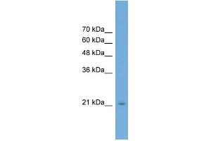 WB Suggested Anti-RAB25 Antibody Titration: 0. (RAB25 antibody  (Middle Region))