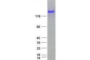 PREX2 Protein (Transcript Variant 1) (Myc-DYKDDDDK Tag)
