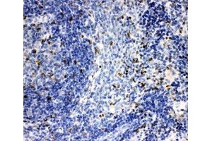 IHC-P: IRAK2 antibody testing of rat spleen tissue (IRAK2 antibody  (C-Term))