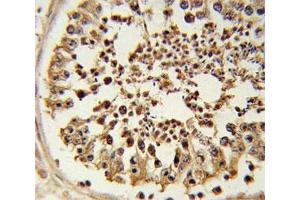 Immunohistochemistry (Formalin-fixed Paraffin-embedded Sections) (IHC (fp)) image for anti-Enhancer of Zeste Homolog 2 (EZH2) antibody (ABIN3028636)