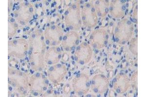 IHC-P analysis of Mouse Kidney Tissue, with DAB staining.