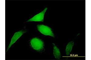 Immunofluorescence of purified MaxPab antibody to PSMD14 on HeLa cell. (PSMD14 antibody  (AA 1-310))