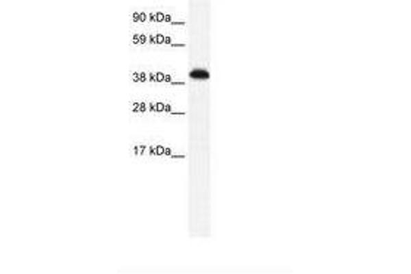 ZNF568 Antikörper  (AA 143-192)