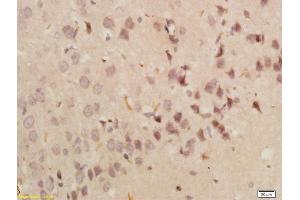 Formalin-fixed and paraffin embedded rat brain labeled with Anti-GRP78 Polyclonal Antibody, Unconjugated (ABIN673554) followed by conjugation to the secondary antibody and DAB staining