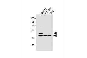 All lanes : Anti-SD3 Antibody at 1:1000 dilution Lane 1: HACAT whole cell lysate Lane 2: HT-1080 whole cell lysate Lane 3: Hela whole cell lysate Lysates/proteins at 20 μg per lane. (SMAD3 antibody  (pSer213))