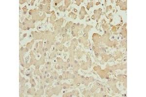 Immunohistochemistry of paraffin-embedded human liver tissue using ABIN7143586 at dilution of 1:100 (AKR7A2 antibody  (AA 100-359))