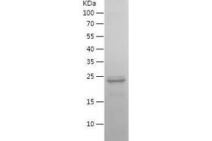 Western Blotting (WB) image for Interferon Regulatory Factor 5 (IRF5) (AA 1-200) protein (His tag) (ABIN7282997) (IRF5 Protein (AA 1-200) (His tag))