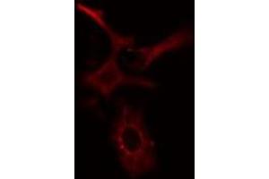 ABIN6277654 staining HeLa cells by IF/ICC. (MLKL antibody  (Internal Region))