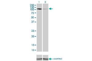 Western Blotting (WB) image for anti-Protein Kinase N1 (PKN1) (AA 462-615) antibody (ABIN562393)