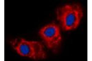Immunofluorescent analysis of Cadherin 23 staining in HEK293T cells. (CDH23 antibody  (N-Term))