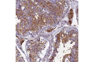 Immunohistochemical staining of human testis with SLC26A10 polyclonal antibody  shows strong cytoplasmic positivity in cells in seminiferus ducts and Leydig cells at 1:200-1:500 dilution.