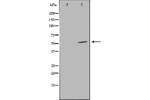Western blot analysis of extracts from HepG2 cells, using LILRA2 antibody. (LILRA2 antibody  (C-Term))