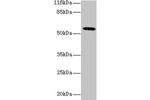Western blot All lanes: GDAP2 antibody at 2 μg/mL + MCF-7 whole cell lysate Secondary Goat polyclonal to rabbit IgG at 1/10000 dilution Predicted band size: 57 kDa Observed band size: 57 kDa (GDAP2 antibody  (AA 1-496))