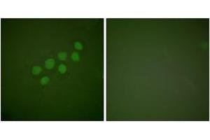 Immunofluorescence analysis of A549 cells, using SKP2/p45 Antibody. (SKP2 antibody  (AA 366-415))