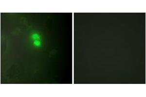 Immunofluorescence analysis of HeLa cells, using Dyskerin Antibody.