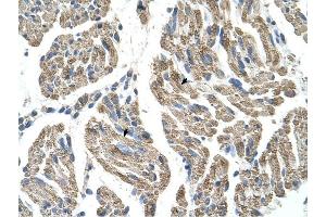 SLC25A38 antibody was used for immunohistochemistry at a concentration of 4-8 ug/ml to stain Skeletal muscle cells (arrows) in Human Muscle. (SLC25A38 antibody  (Middle Region))