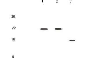 Human recombinant protein KIR2DL1, KIR2DL3 and KIR2DL4 (each 20ng per well) were resolved by SDS-PAGE, transferred to PVDF membrane and probed with anti-human KIR2DL4 (1:500). (KIR2DL4/CD158d antibody)