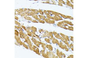 Immunohistochemistry of paraffin-embedded Rat brain using TR antibody (ABIN1683134, ABIN5664756, ABIN5664758 and ABIN6220605) at dilution of 1:100 (40x lens). (TRAP1 antibody  (AA 445-704))