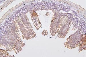 IHC analysis of PRKCD using anti-PRKCD antibody (ABIN7601631).