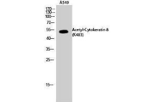 Western Blotting (WB) image for anti-Keratin 8 (KRT8) (acLys483) antibody (ABIN3181888) (KRT8 antibody  (acLys483))