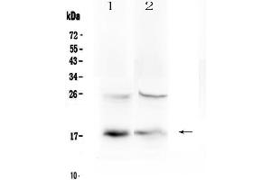 Western blot analysis of TSLP using anti-TSLP antibody . (Thymic Stromal Lymphopoietin antibody)