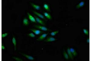 Immunofluorescence staining of Hela cells with ABIN7169929 at 1:100, counter-stained with DAPI. (SCN9A antibody  (AA 1849-1988))