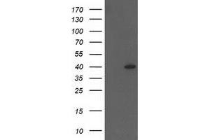 HEK293T cells were transfected with the pCMV6-ENTRY control (Left lane) or pCMV6-ENTRY HSPBP1 (Right lane) cDNA for 48 hrs and lysed. (HSPBP1 antibody)