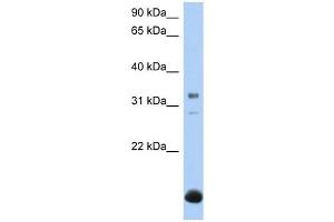 B3GALT6 antibody used at 1 ug/ml to detect target protein. (B3GALT6 antibody  (N-Term))