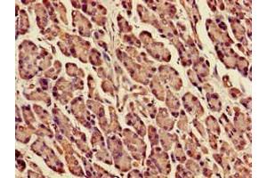 Immunohistochemistry (IHC) image for anti-Dolichyl-Phosphate Mannosyltransferase Polypeptide 1, Catalytic Subunit (DPM1) (AA 2-260) antibody (ABIN7150590)
