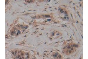 Immunohistochemistry (IHC) image for anti-Minichromosome Maintenance Complex Component 5 (MCM5) (AA 331-537) antibody (ABIN7435823)
