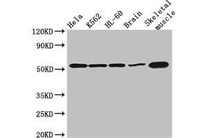 Western Blot Positive WB detected in: Hela whole cell lysate, K562 whole cell lysate, HL60 whole cell lysate, Mouse brain tissue, Mouse skeletal muscle tissue All lanes: ZBTB43 antibody at 3 μg/mL Secondary Goat polyclonal to rabbit IgG at 1/50000 dilution Predicted band size: 53 kDa Observed band size: 53 kDa (ZBTB43 antibody  (AA 165-467))