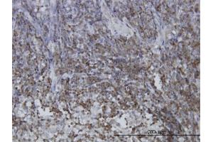 Immunoperoxidase of monoclonal antibody to STAT5B on formalin-fixed paraffin-embedded human lymph node. (STAT5B antibody  (AA 678-787))