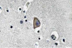 Immunohistochemistry (IHC) analyzes of CD3-epsilon antibody in paraffin-embedded human brain tissue. (CD3 antibody)