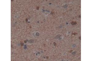 Figure. (BIN1 antibody  (AA 1-276))