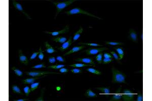 Immunofluorescence of purified MaxPab antibody to IFNA17 on HeLa cell. (IFNA17 antibody  (AA 1-189))